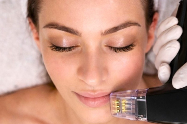 Фракционный RF-лифтинг Morpheus8