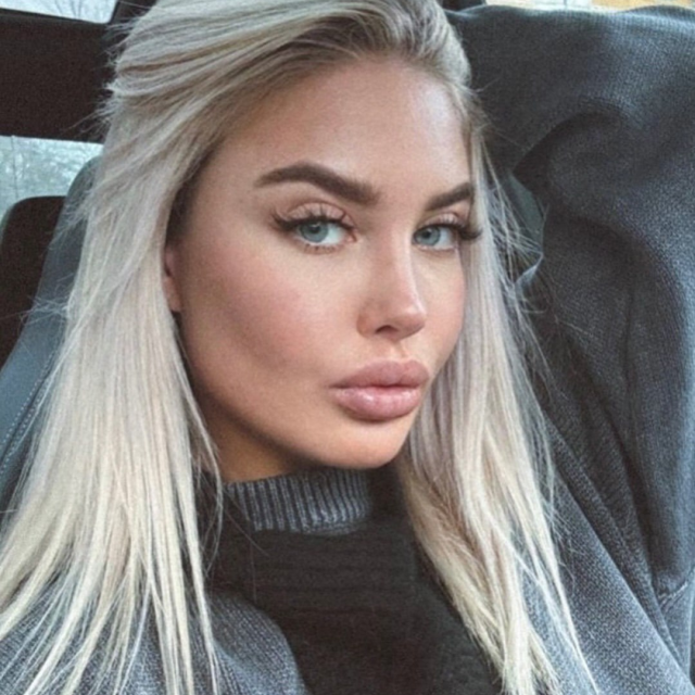 Была проведена закрытая риносептопластика