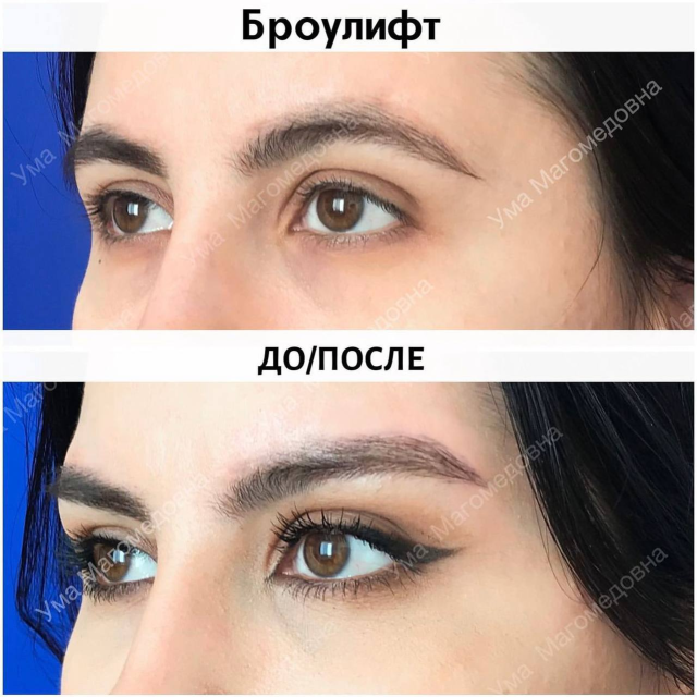 Броулифт