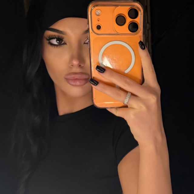 Безумно красивая пациентка  Шамиля Асадулаевича после ринопластики