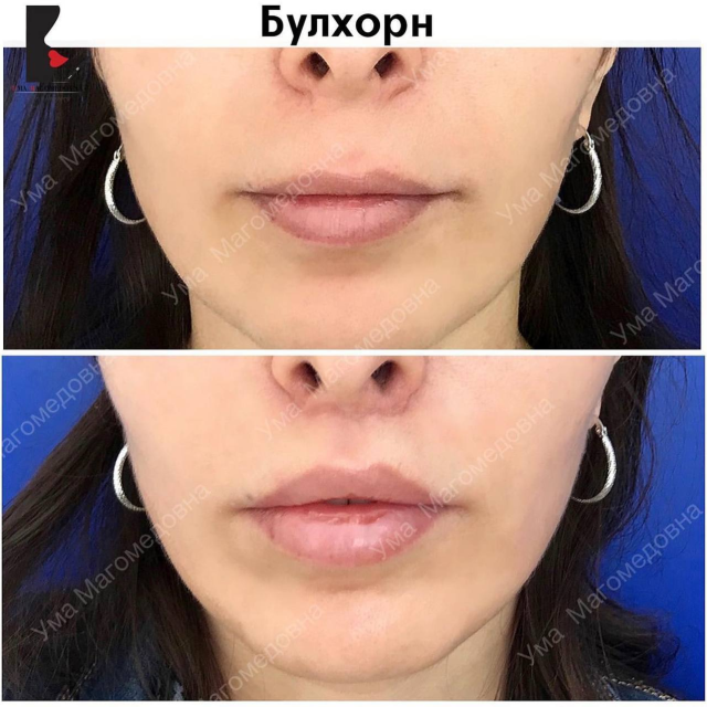 Булхорн