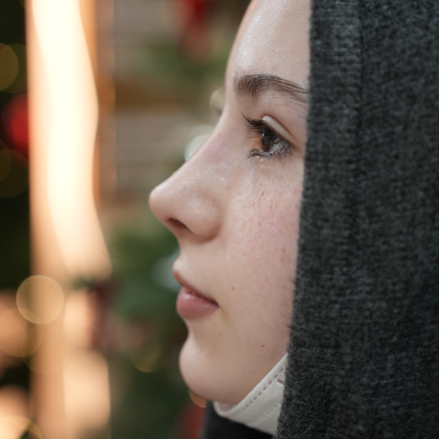 Снятие гипса. Результат на 10 день.