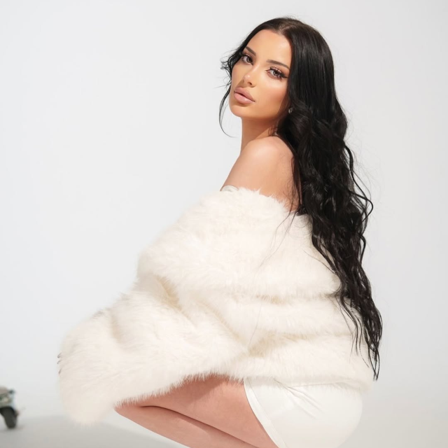 Ринопластика ✨ 8 месяцев после операции