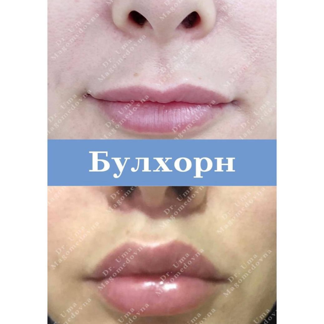 Булхорн