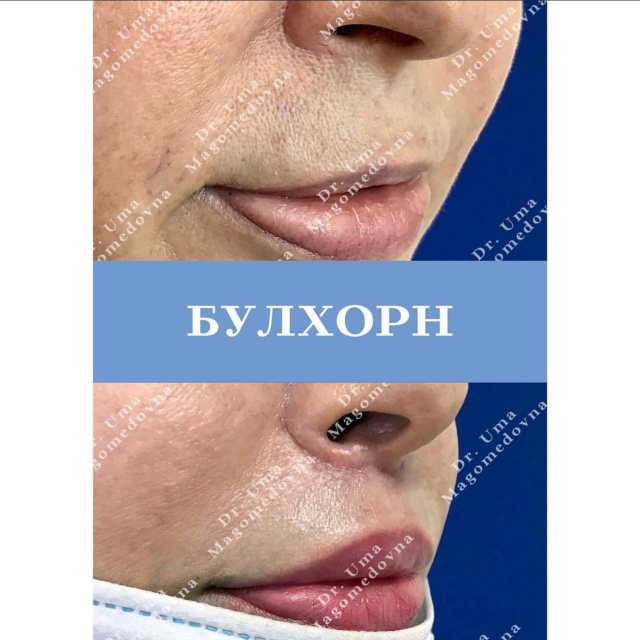 Булхорн
