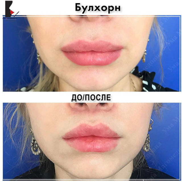 Булхорн