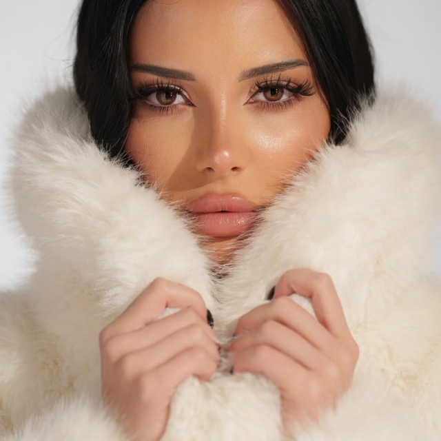 Ринопластика ✨ 8 месяцев после операции