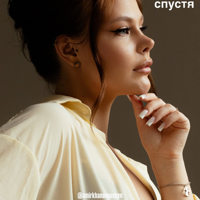 После 3 месяцев снятия гипса