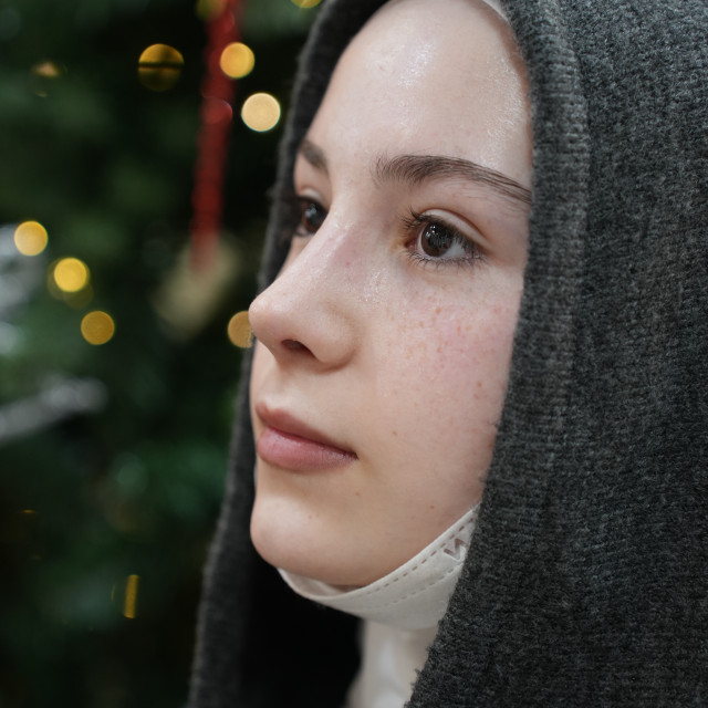 Снятие гипса. Результат на 10 день.