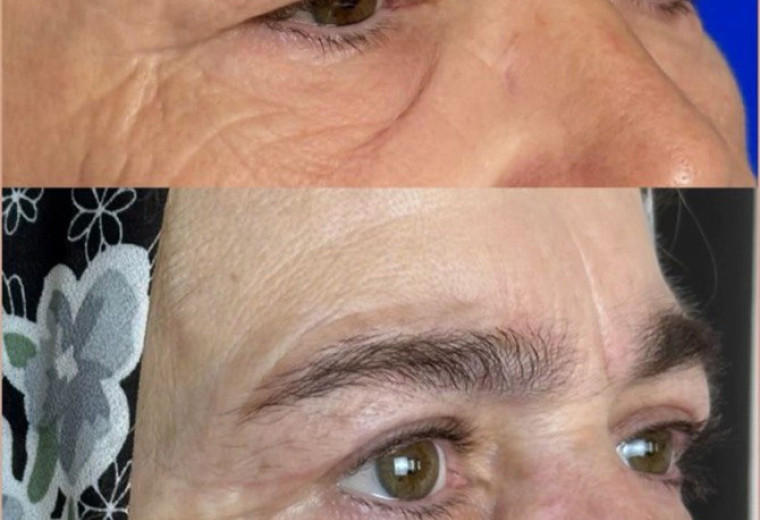 До/после Магомедалиева Ума Магомедовна