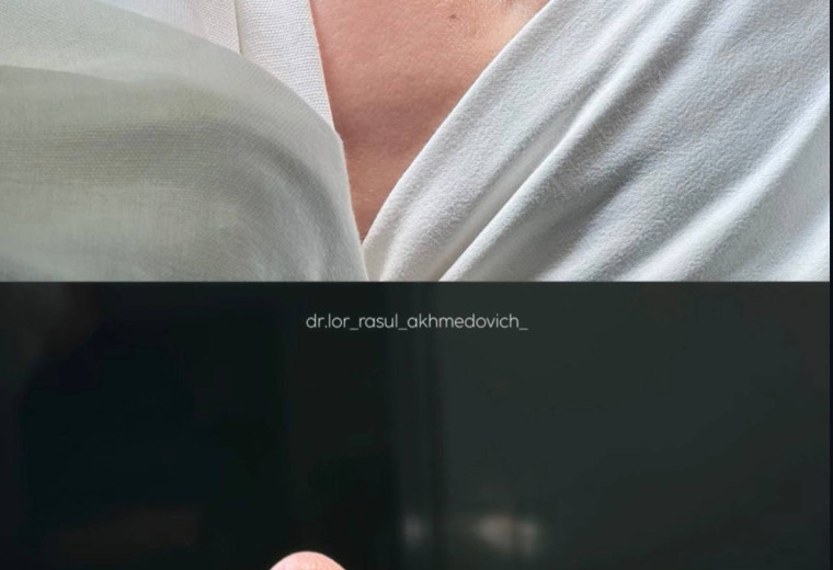 До/после Кадырбеков Магомедрасул Ахмедович